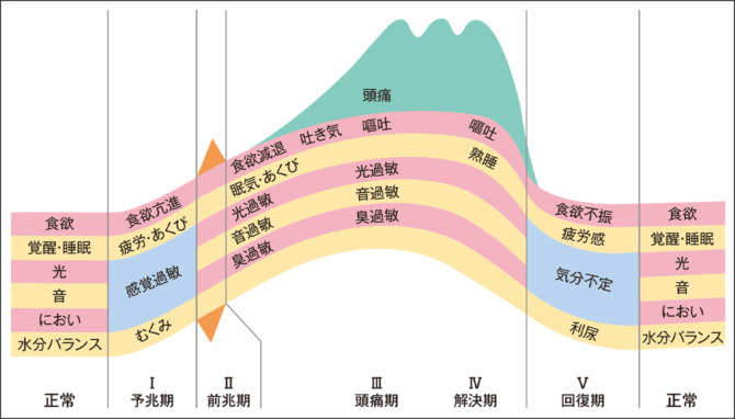 つらい症状からついに解放！？ 進化する片頭痛の治療法