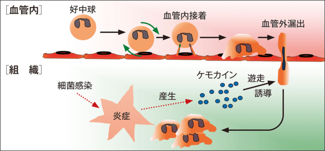 化膿性関節炎 白血球 検査 – 感染性膝関節炎・化膿性膝関節炎 – AQJOCO