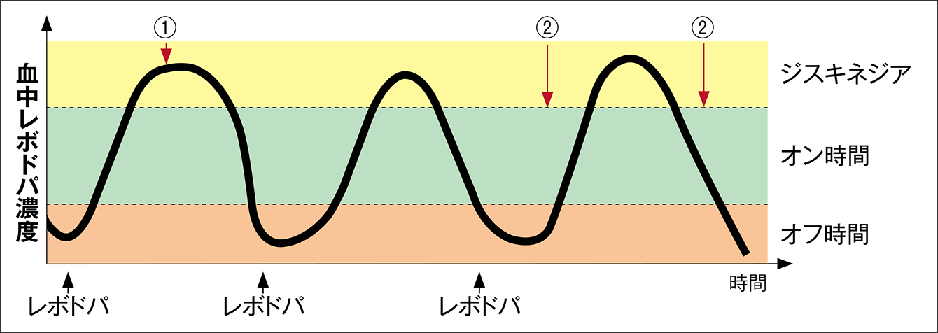 インブリハの副作用